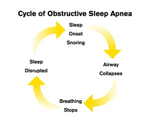 Sleep Apnea Cycle