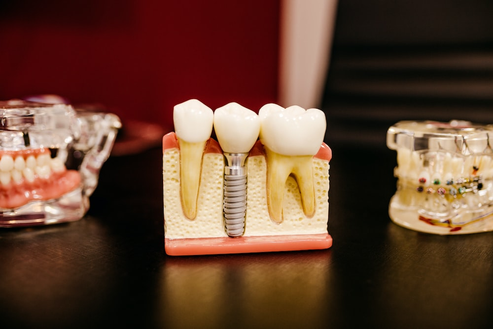 A set of dental models